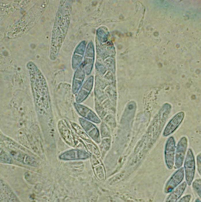 macrostoma