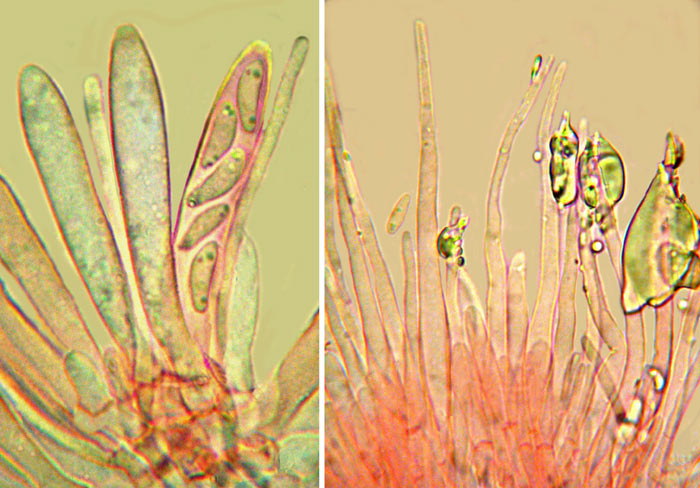 macrostoma
