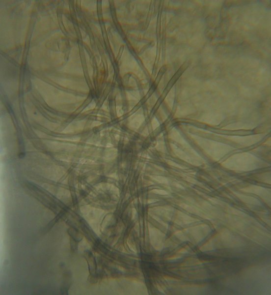 macrostoma