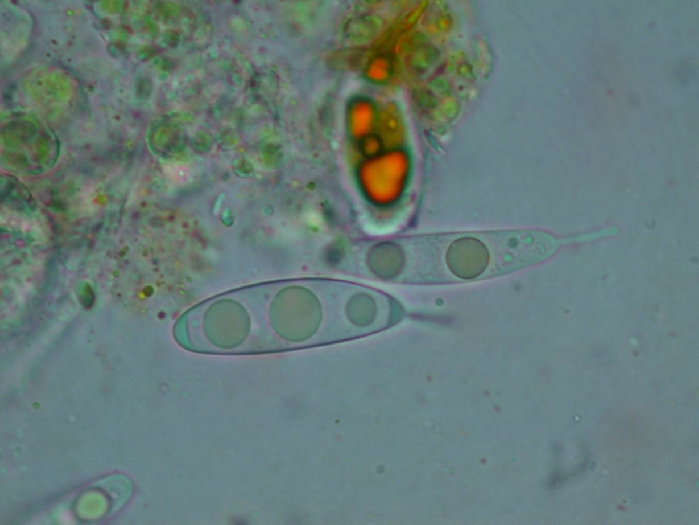 macrostoma