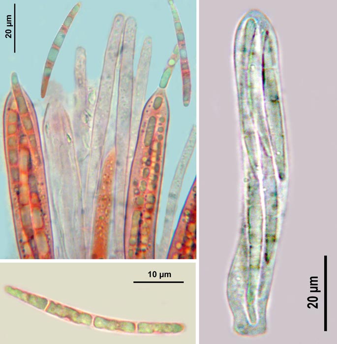 macrostoma