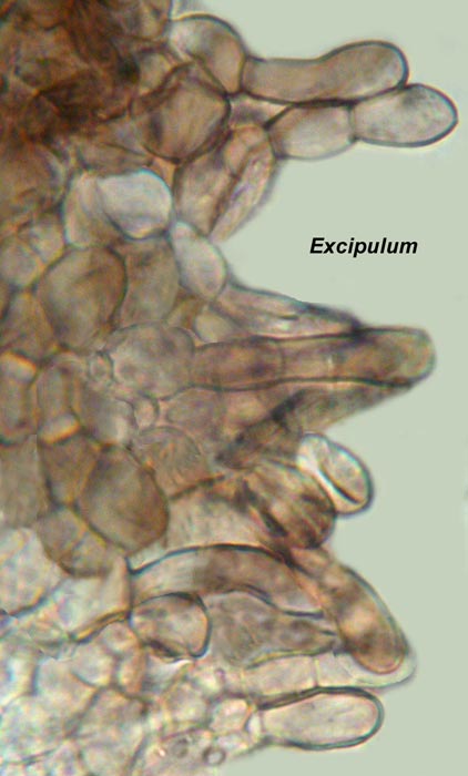 macrostoma