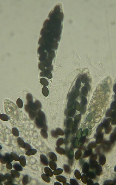 macrostoma