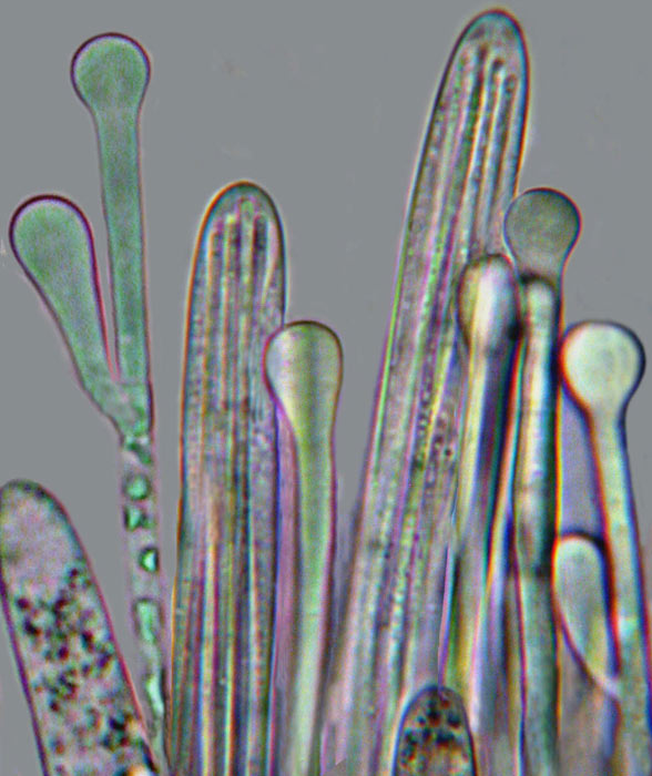 macrostoma