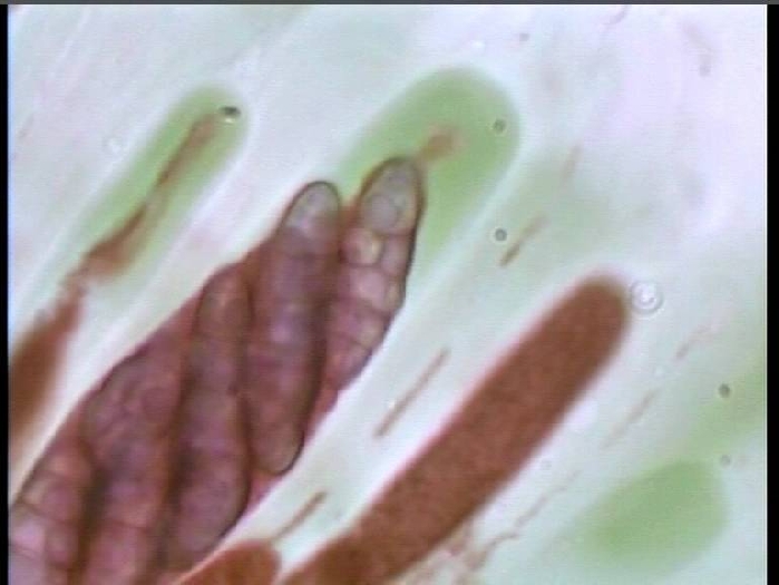 macrostoma