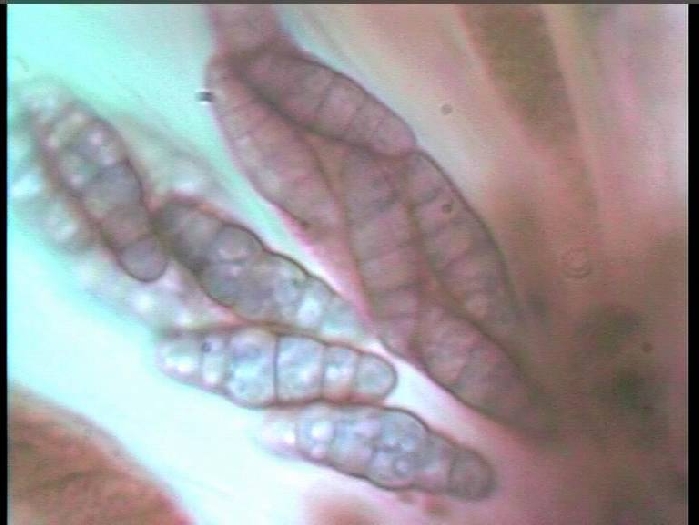 macrostoma