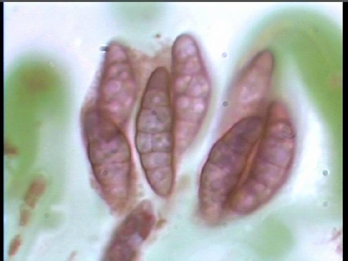 macrostoma