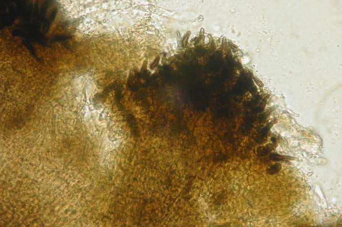macrostoma