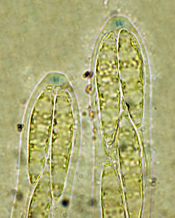 macrostoma