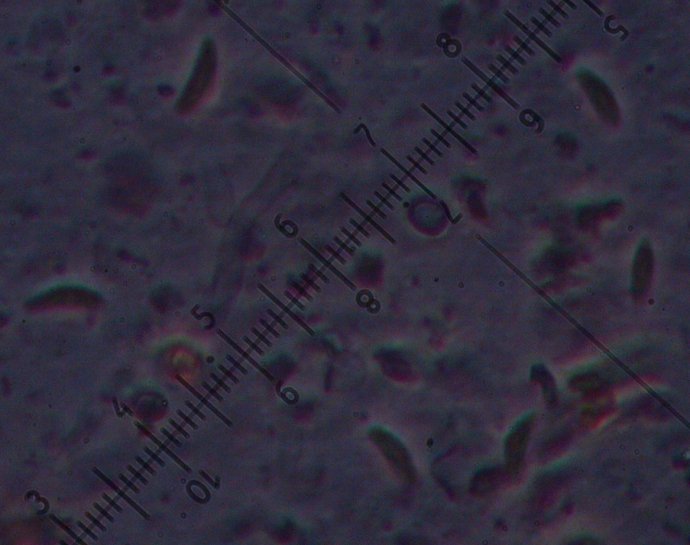 macrostoma