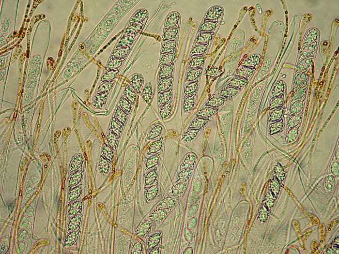 macrostoma