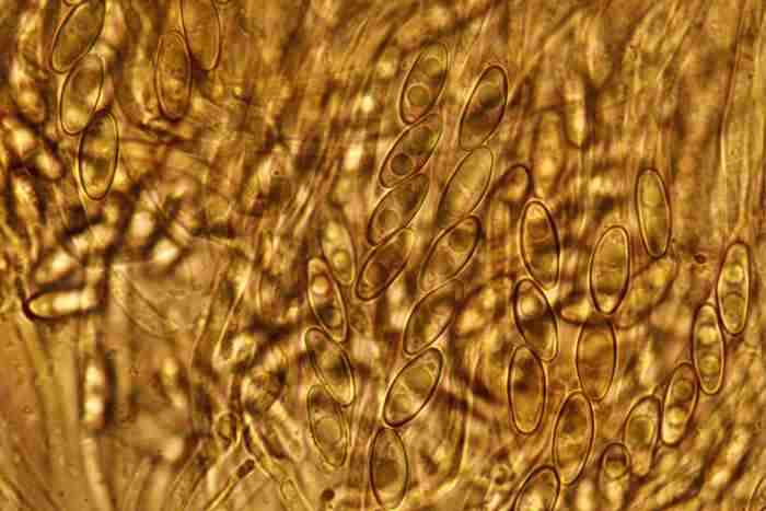macrostoma