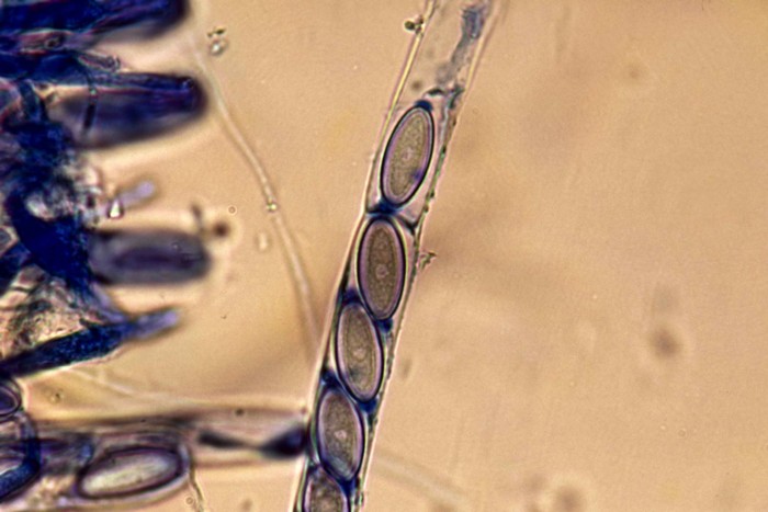 macrostoma