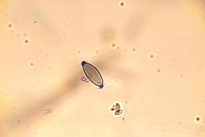 macrostoma