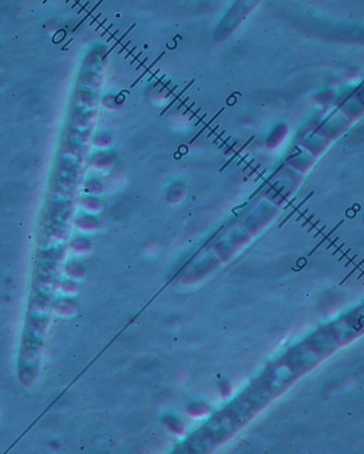 macrostoma