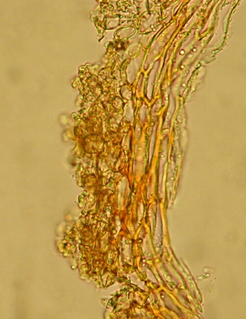 macrostoma