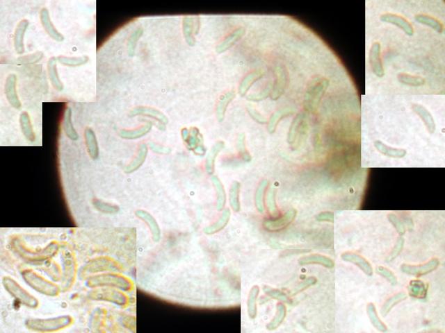 macrostoma