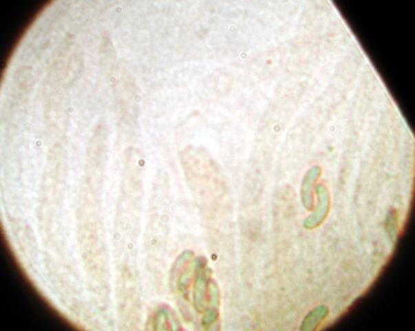 macrostoma