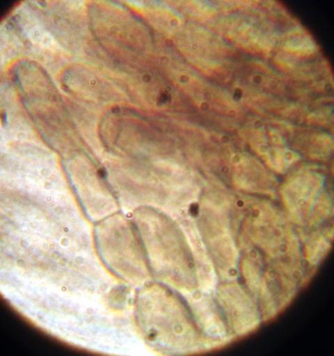 macrostoma