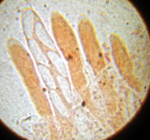 macrostoma