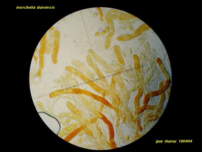 macrostoma