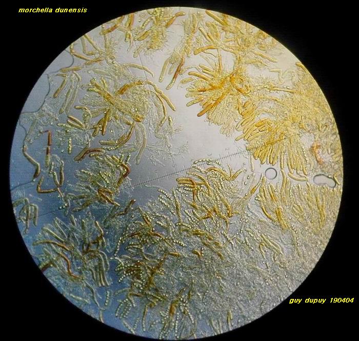 macrostoma