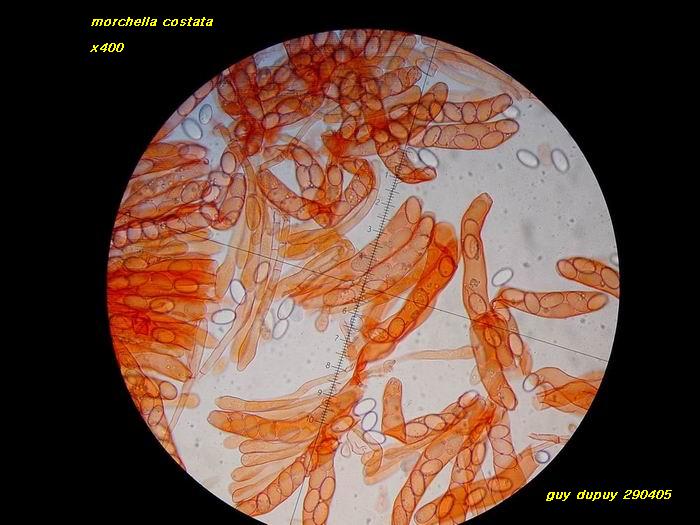 macrostoma