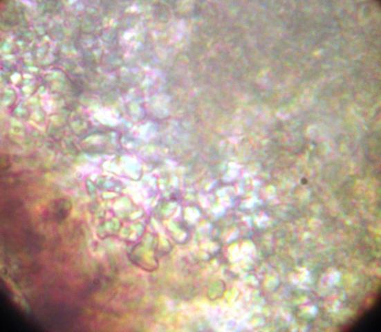 macrostoma