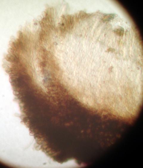 macrostoma