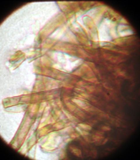 macrostoma