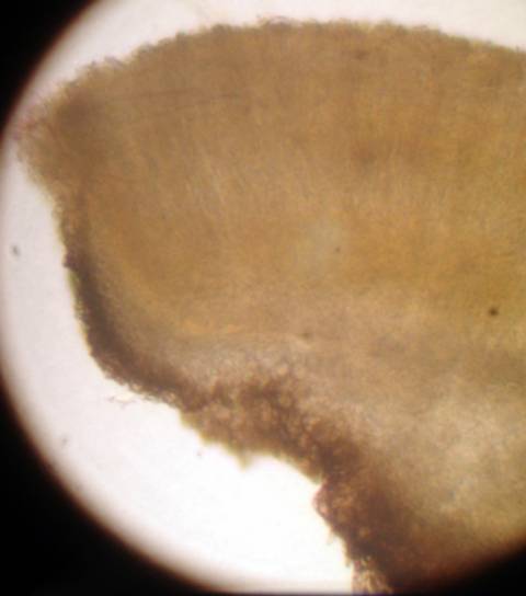macrostoma