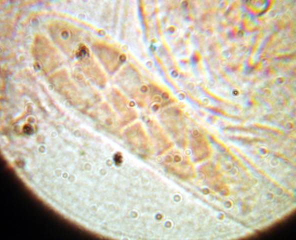 macrostoma