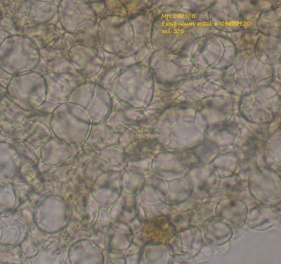macrostoma