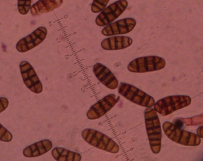macrostoma