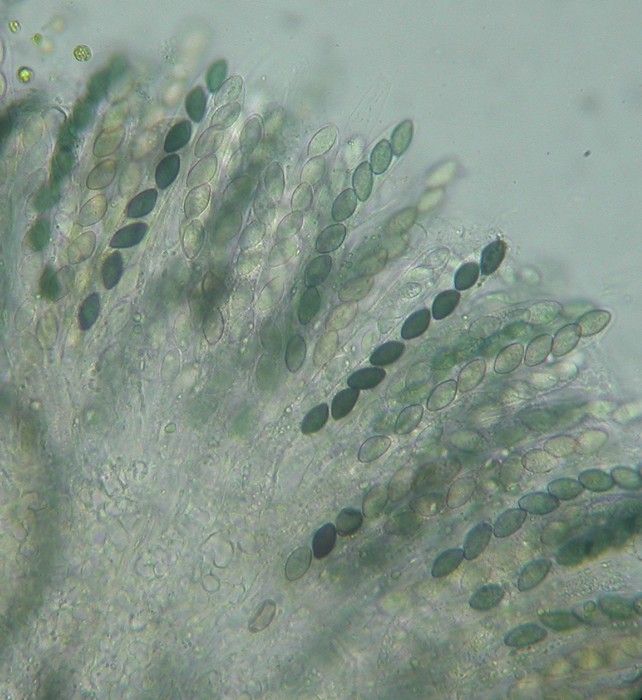 macrostoma