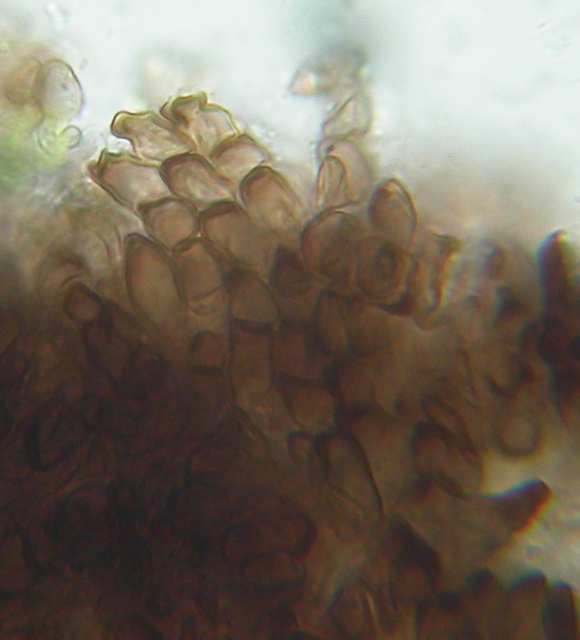 macrostoma
