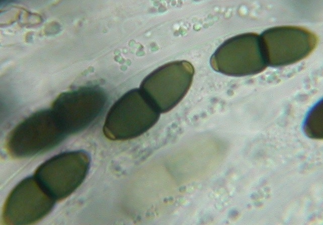 macrostoma