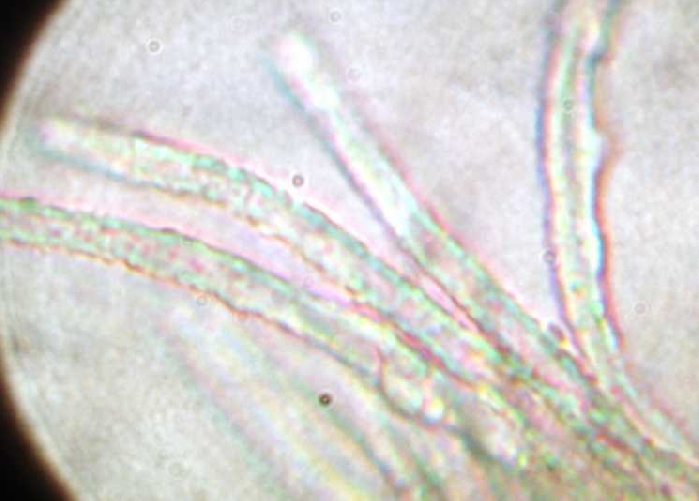macrostoma