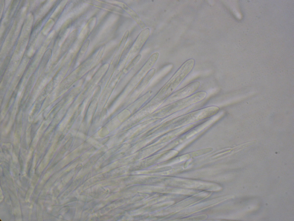 macrostoma
