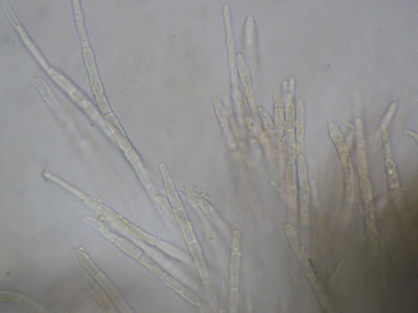 macrostoma