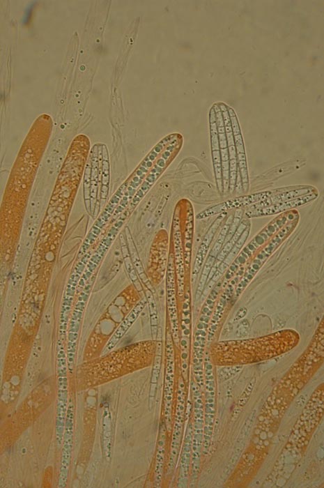 macrostoma