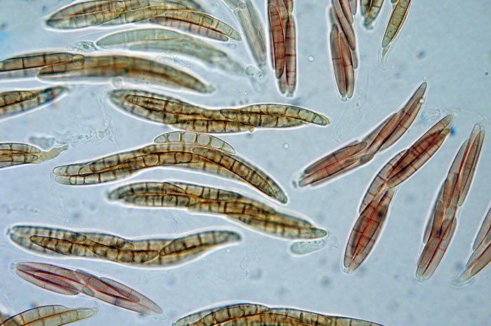 macrostoma