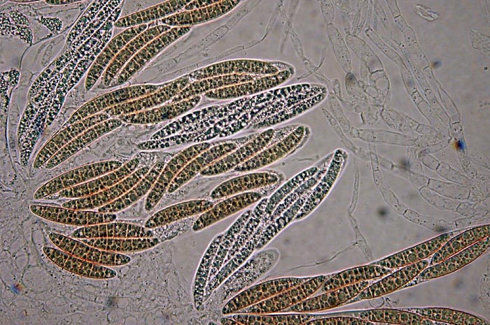 macrostoma