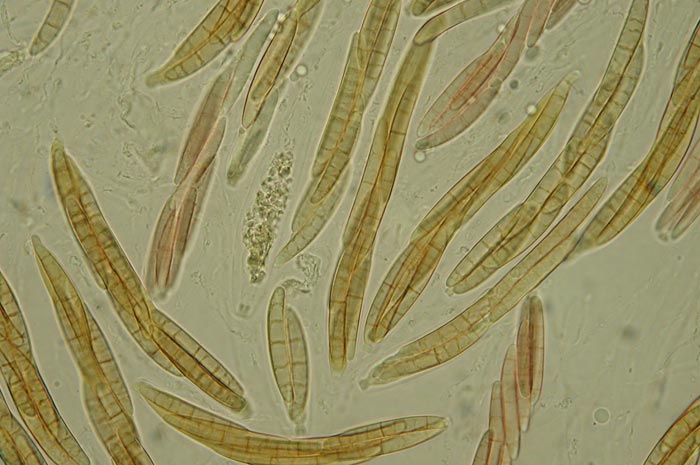 macrostoma