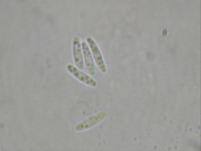 macrostoma