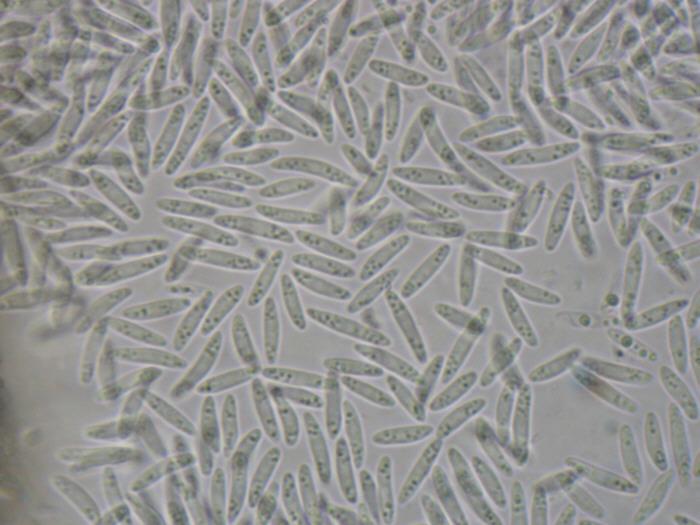 macrostoma