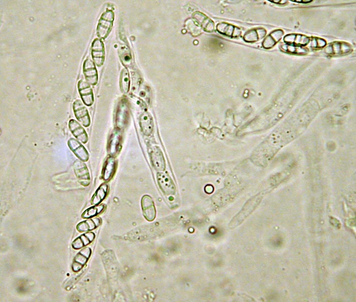 macrostoma