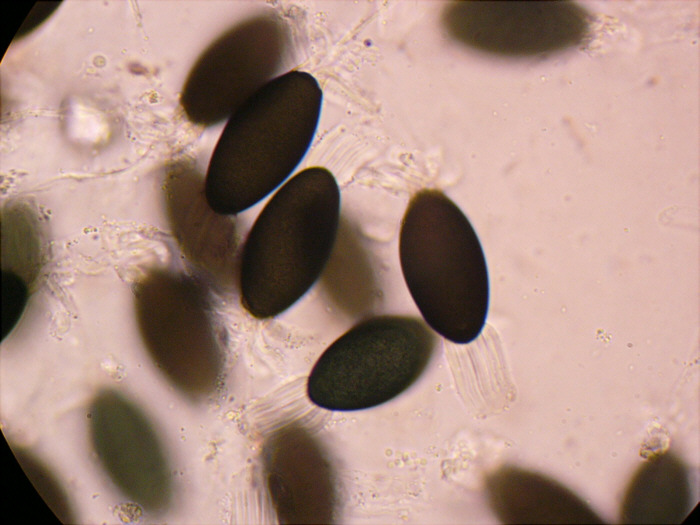 macrostoma