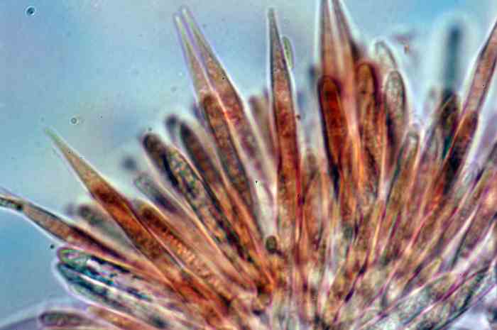macrostoma