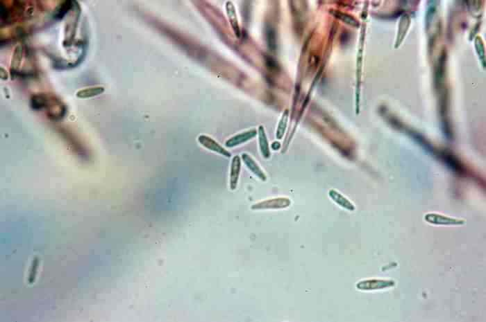macrostoma